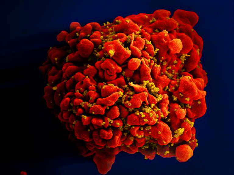 Anticorpo ‘três em um’ protege macacos contra o HIV, diz estudo