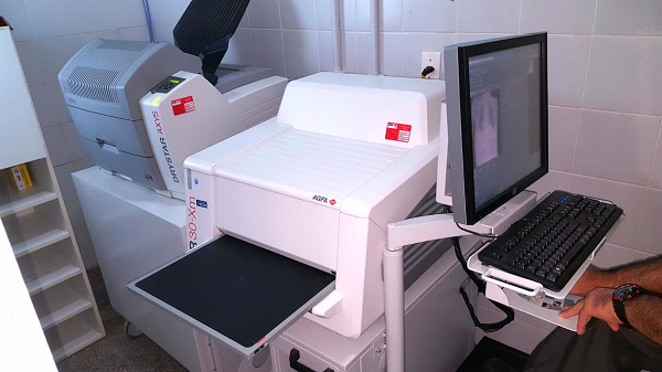 Digitalização de radiografias adotado no HU de Lagarto beneficia usuários e profissionais