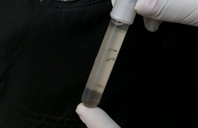 Aracaju está entre as três capitais que não correm risco de surto de dengue, zika e chikungunya