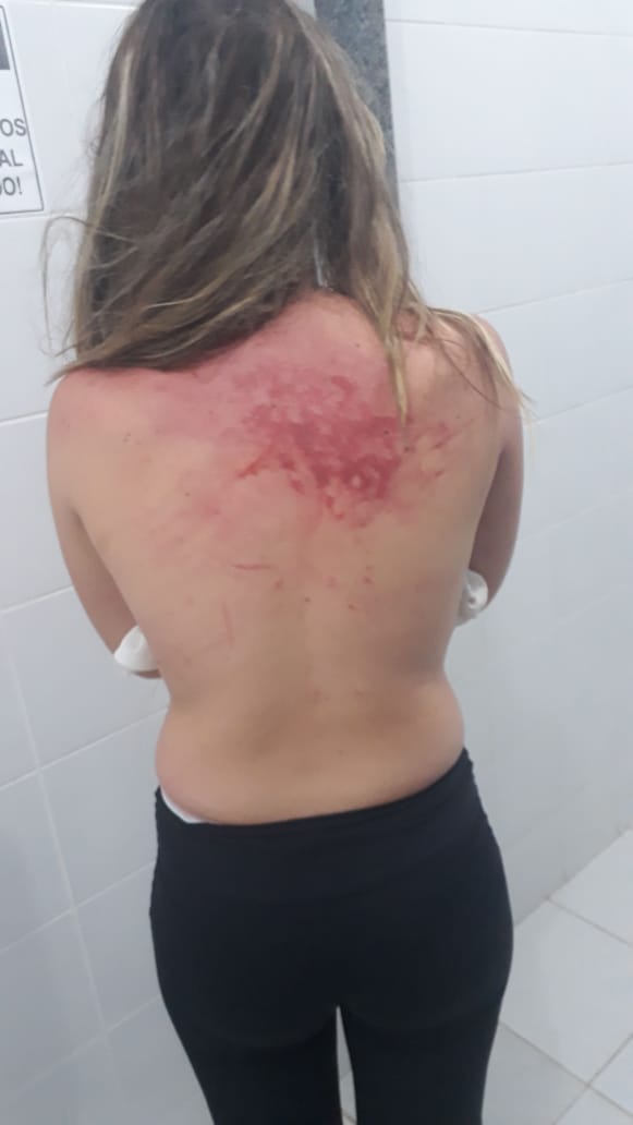 Jovem é atropelada em seguida agredida por duas mulheres no centro de Tobias Barreto