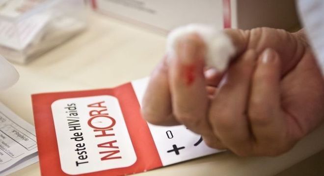 Quase 10 milhões de pessoas ainda não sabem que têm o vírus HIV.