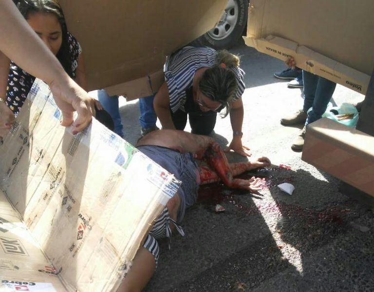 Mulher é atropelada em Lagarto