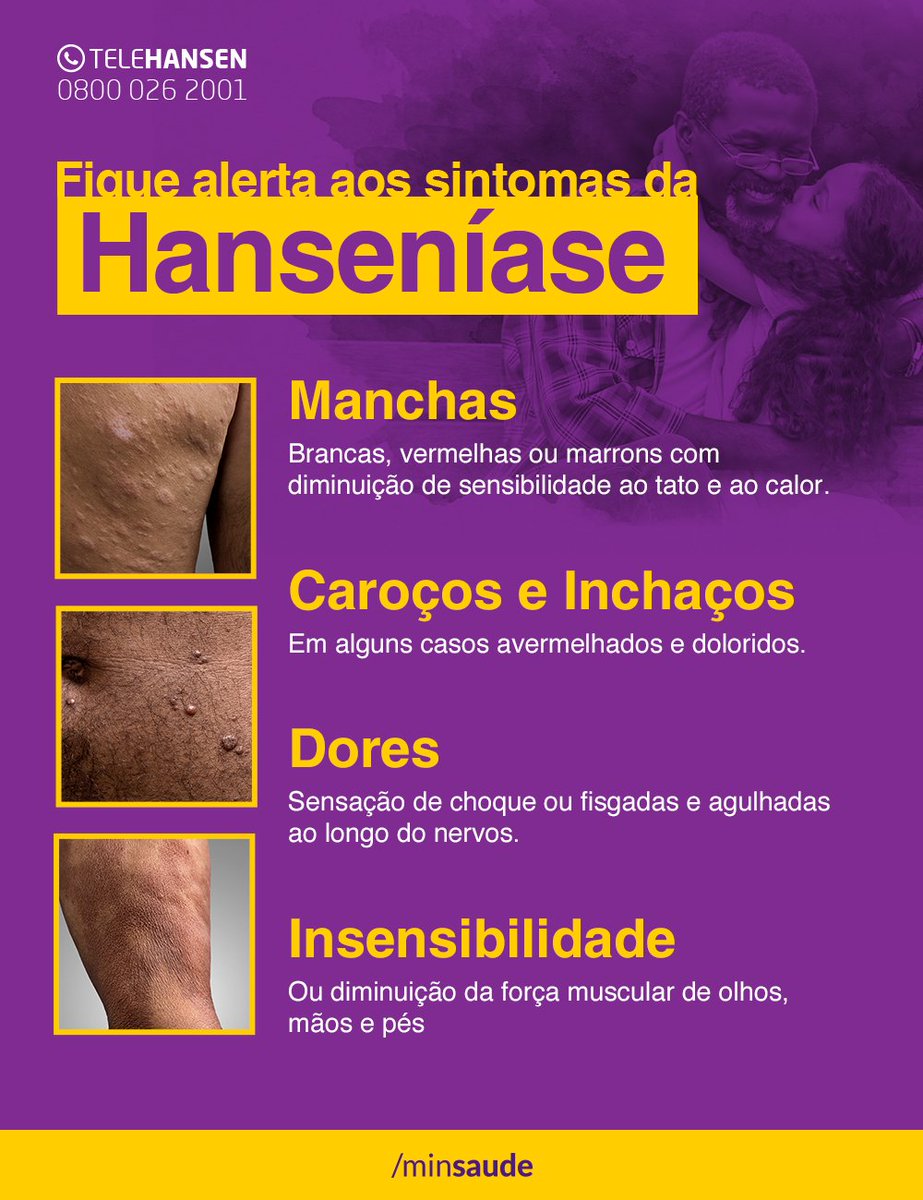 Quais os principais sintomas da Hanseníase - OncoExpress
