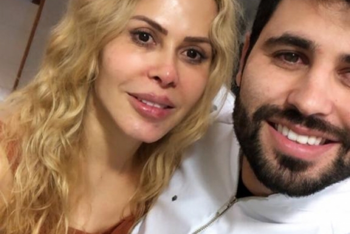 Joelma surge irreconhecível após procedimento no rosto