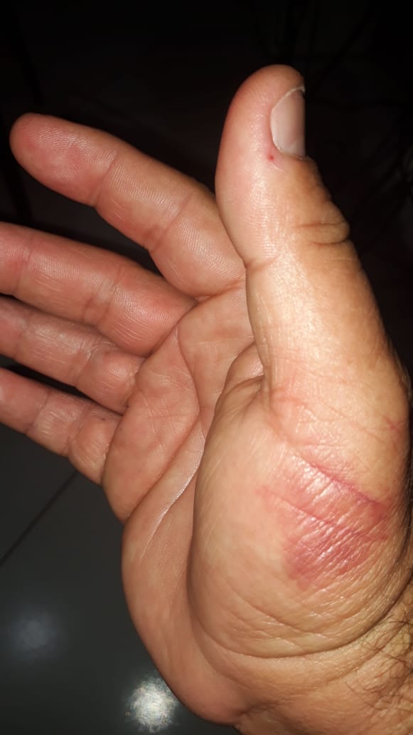 Desatenção causa transtorno em paciente do Hospital Universitário de Lagarto