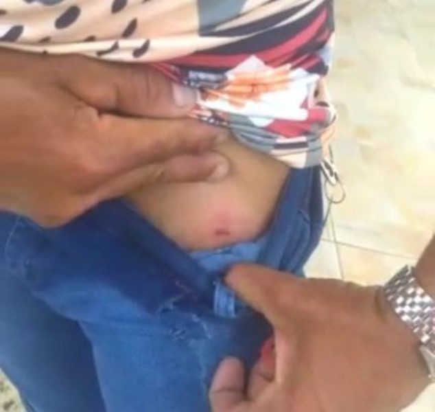 Assaltantes disparam contra vítima que é salva pela carteira, em Lagarto