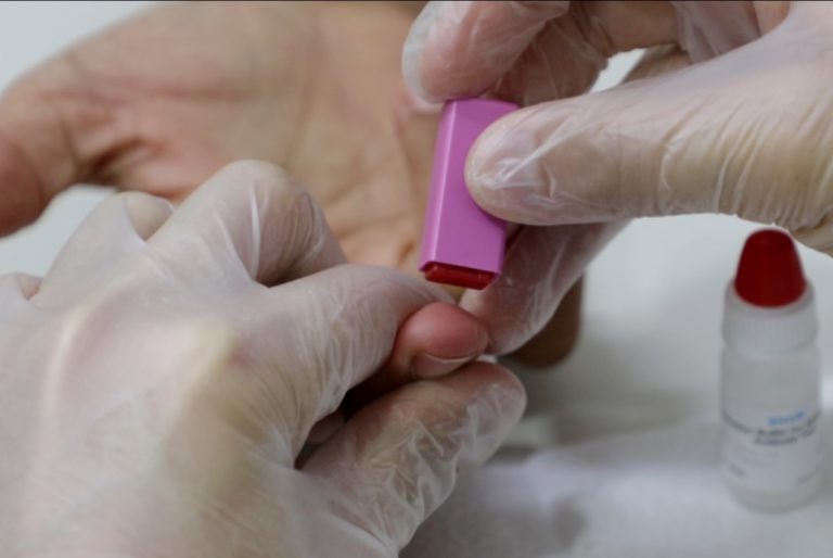 Covid-19: Governo começa a distribuir testes rápidos aos 75 municípios do estado