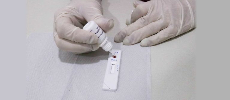 Saiba a diferença entre PCR, teste-rápido e sorologia para detecção da Covid-19