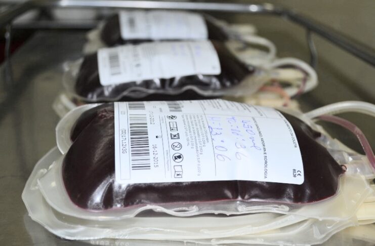 Bolsa-de-sangue-passa-por-fracionamento-de-componentes-após-teste