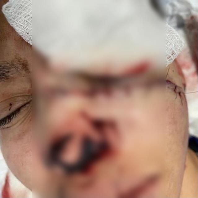 Jovem trans é agredido com golpes de facão