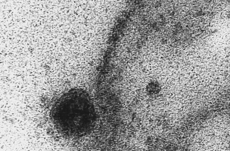 Início do processo de infecção pelo patógeno. Registro do momento exato em que uma célula é infectada pelo novo coronavírus, obtido durante estudo que investiga a replicação viral do Sars-CoV-2 realizado pelos Laboratório de Morfologia e Morfogênese Viral e Laboratório de Vírus Respiratórios e do Sarampo, Instituto Oswaldo Cruz.