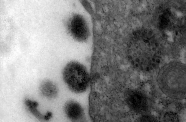 Partículas infectivas deixam o interior da célula em direção a outra célula saudável dando continuidade ao ciclo de infecção. Registro do momento exato em que uma célula é infectada pelo novo coronavírus, obtido durante estudo que investiga a replicação viral do Sars-CoV-2 realizado pelos Laboratório de Morfologia e Morfogênese Viral e Laboratório de Vírus Respiratórios e do Sarampo, Instituto Oswaldo Cruz.