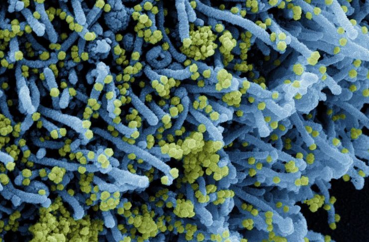 Novo Coronavírus SARS-CoV-2
Micrografia eletrônica de varredura colorida de uma célula infectada com uma cepa variante de partículas do vírus SARS-CoV-2 (laranja), isolada de uma amostra de paciente. Imagem capturada no Centro de Pesquisa Integrada (IRF) do NIAID em Fort Detrick, Maryland. Crédito: NIAID