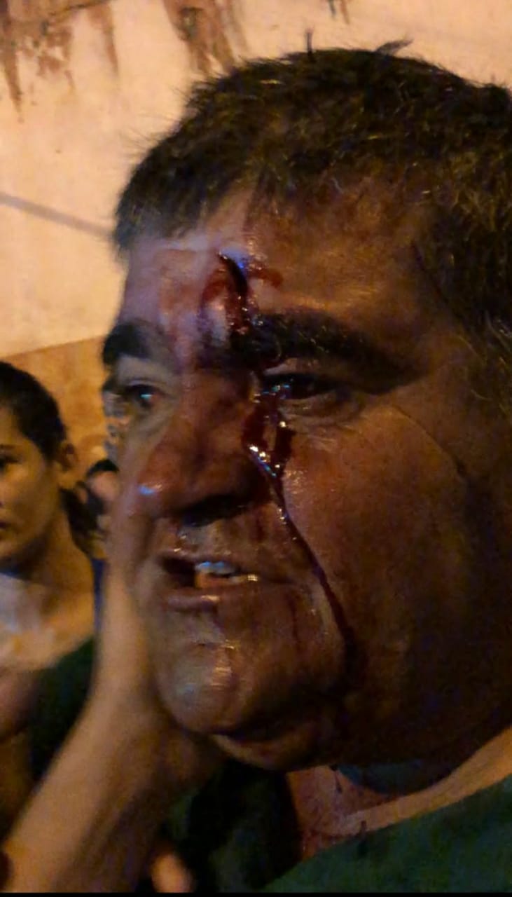 Vídeo: Encontro de atos políticos termina com um ferido em Lagarto