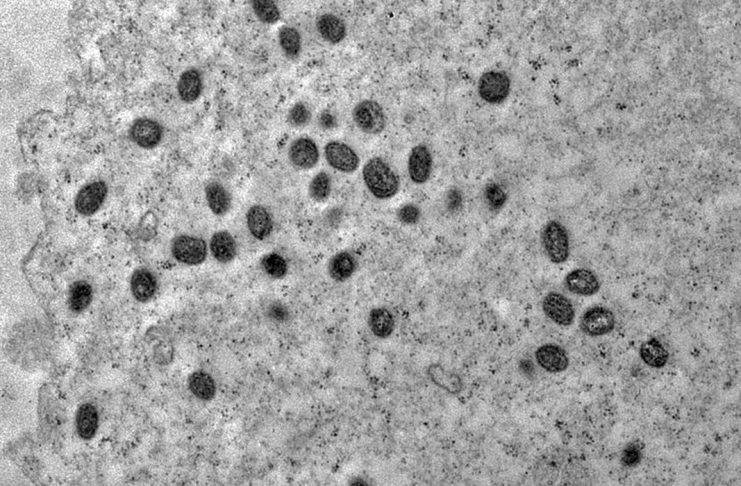 A varíola dos macacos é transmitida pelo vírus monkeypox, que pertence ao gênero orthopoxvirus.
(Foto: Débora F. Barreto-Vieira/IOC/Fiocruz)