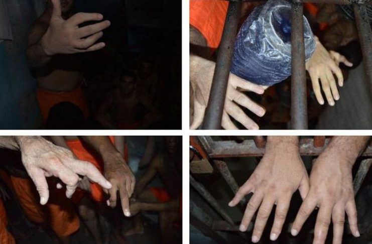 Tortura/dedos quebrados - Em relatório sobre missão ao estado do Ceará, imagem mostra mãos de diferentes presos com indícios de traumatismo nos dedos. Foto: Acervo do MNPCT (2019)