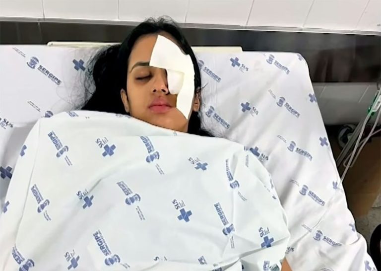 Salgado: Família realiza campanha para salvar a visão de jovem agredida pelo ex