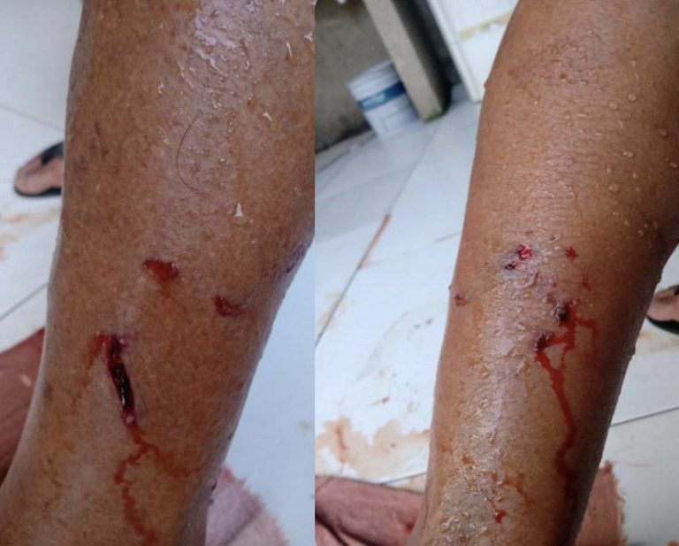 Homem é atacado por cachorro e sofre queda de motocicleta em Lagarto