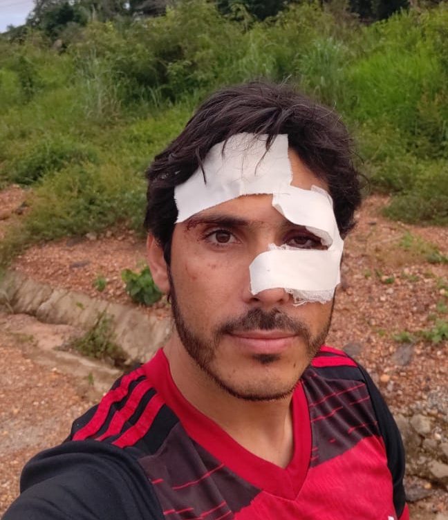 Caminhoneiro de Lagarto sofre acidente com carreta carregada de Madeira