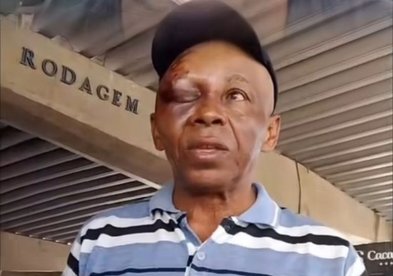 Idoso é agredido na rodoviária de Aracaju