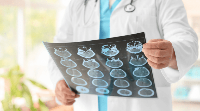 Ipesaúde destaca desafios e avanços no enfrentamento do câncer cerebral