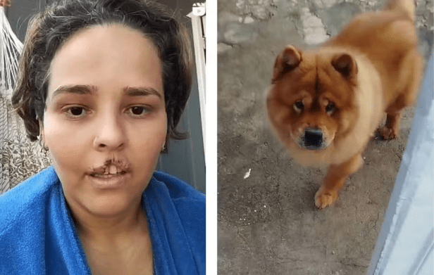 Cachorro que mordeu e arrancou lábio de tutora é submetido à eutanásia