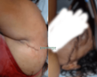 Mulher é atacada com spray de pimenta e faca em Riachão do Dantas