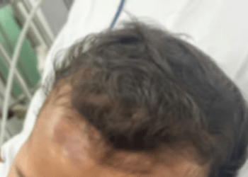 Mãe relata que bebê de 8 meses foi atingido por aparelho em hospital de Aracaju