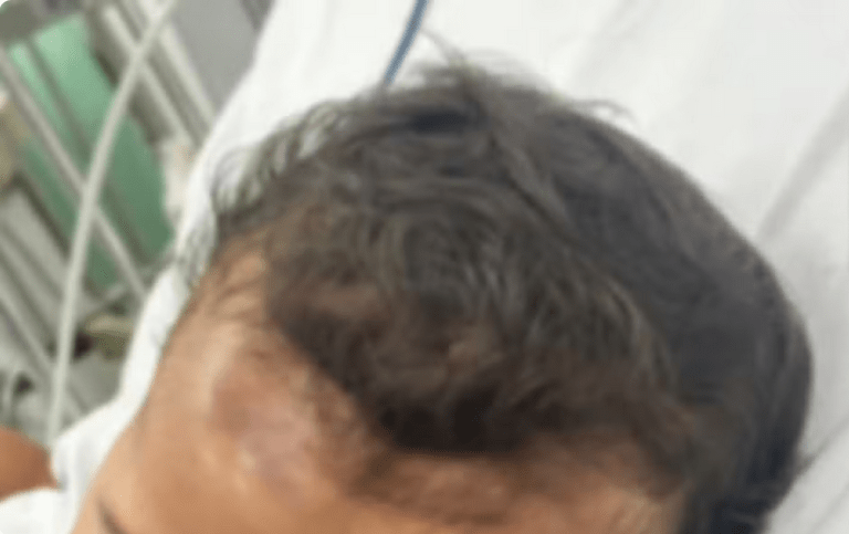 Mãe relata que bebê de 8 meses foi atingido por aparelho em hospital de Aracaju